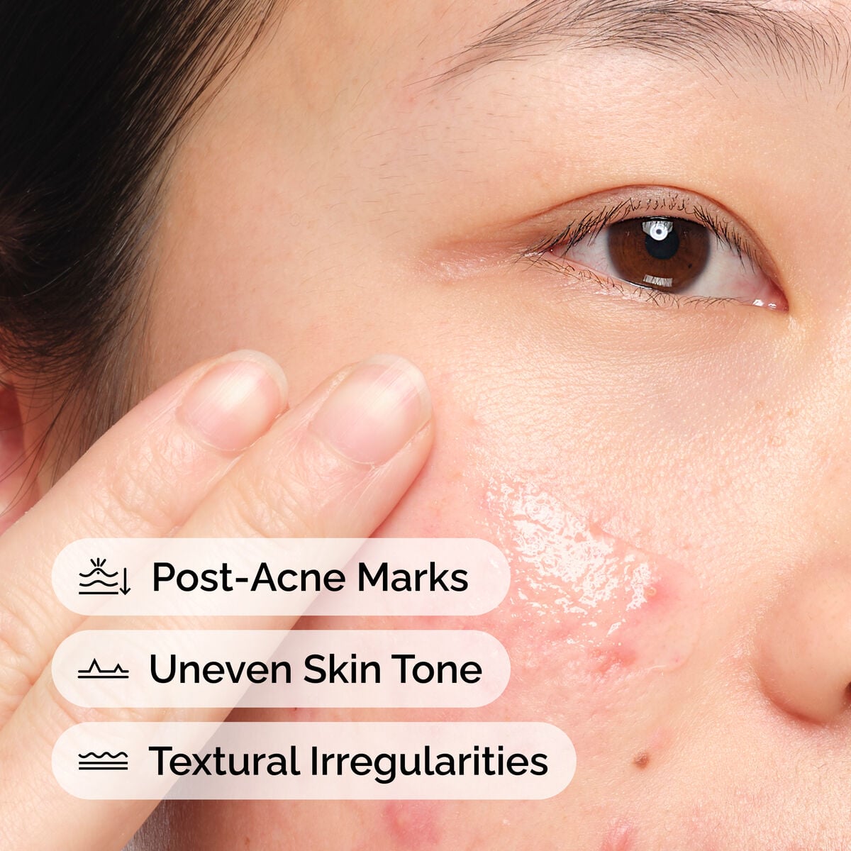 Aloe + NAG Solution Daily Treatment Ritual P7
