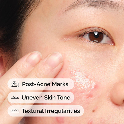 Aloe + NAG Solution Daily Treatment Ritual P7