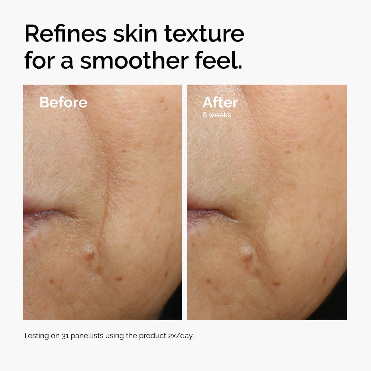 Caffeine + Escin Face Serum Targeted Serum Care X1
