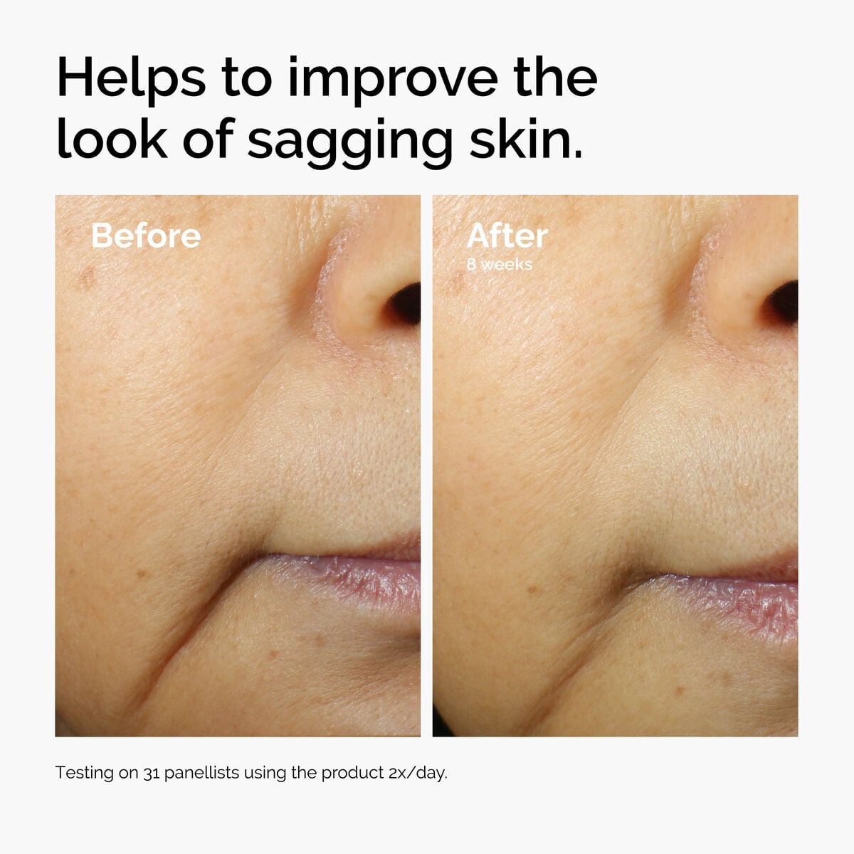 Caffeine + Escin Face Serum Targeted Serum Care X1