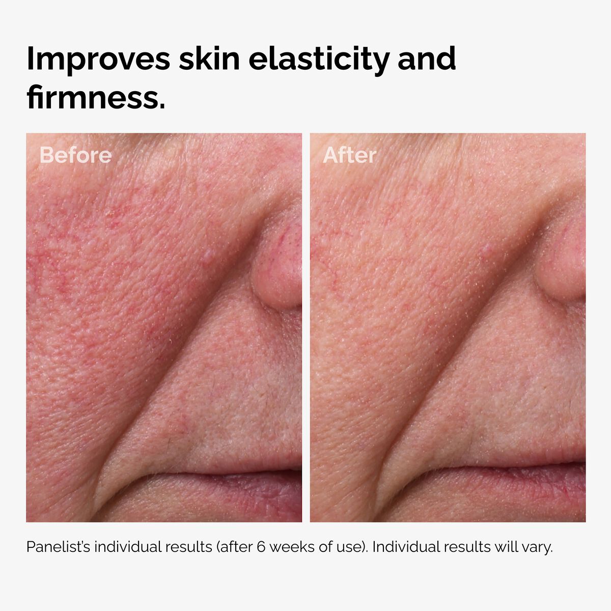 Fermented Rose Hip Seed Oil Nourishing Face Oil H4