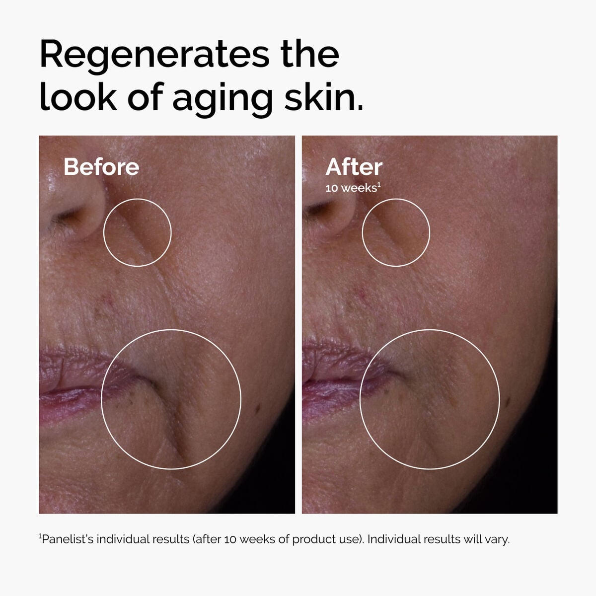 GF Solution Targeted Serum Care R6