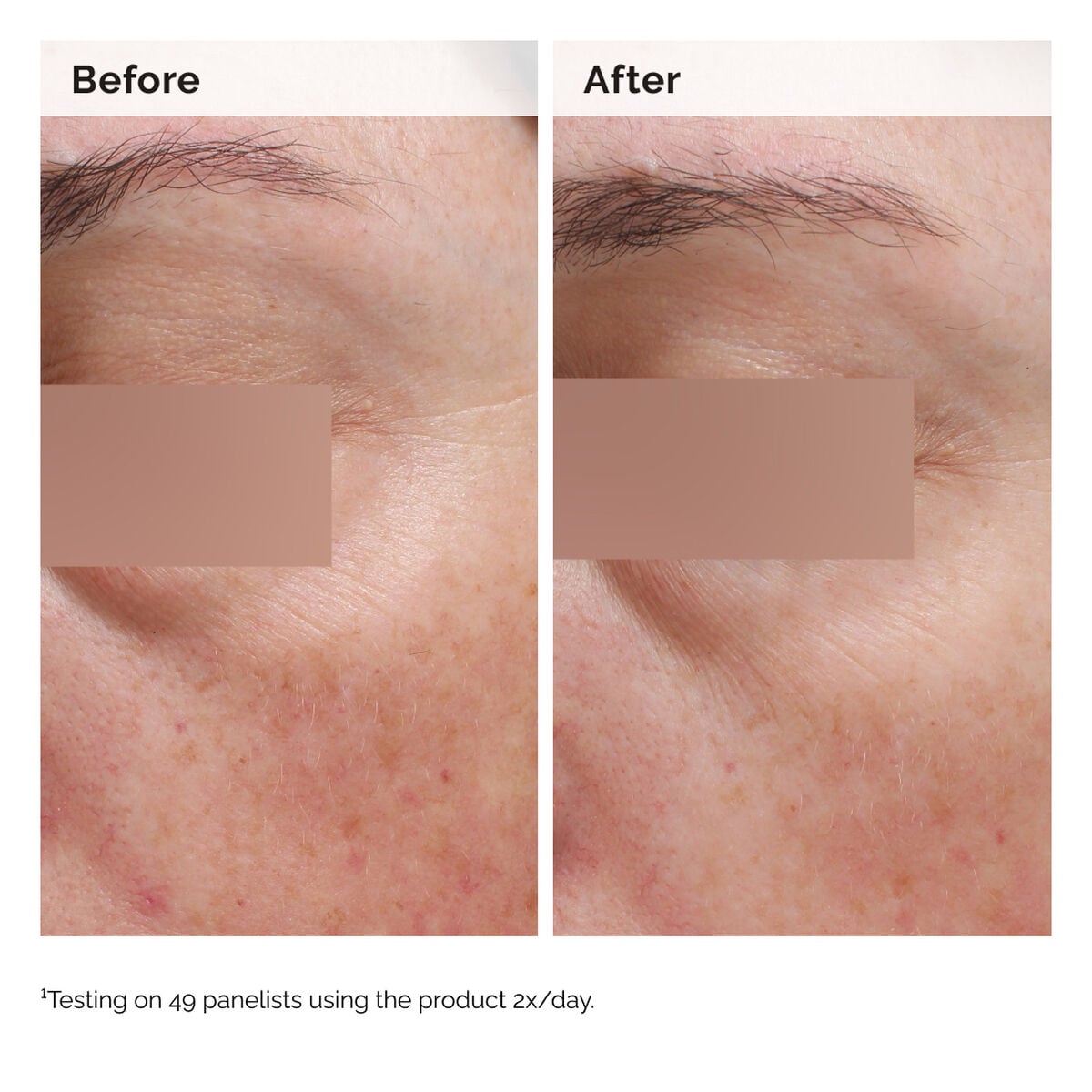 Niacinamide Face and Body Emulsion Targeted Serum Care R9