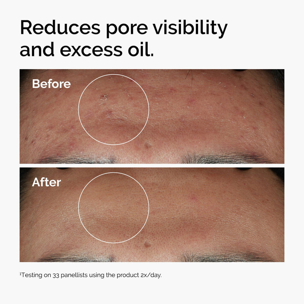 Niacinamide + Zinc Targeted Serum Care B5