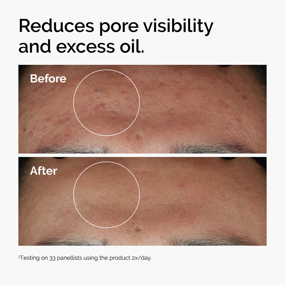 Niacinamide + Zinc Targeted Serum Care B5