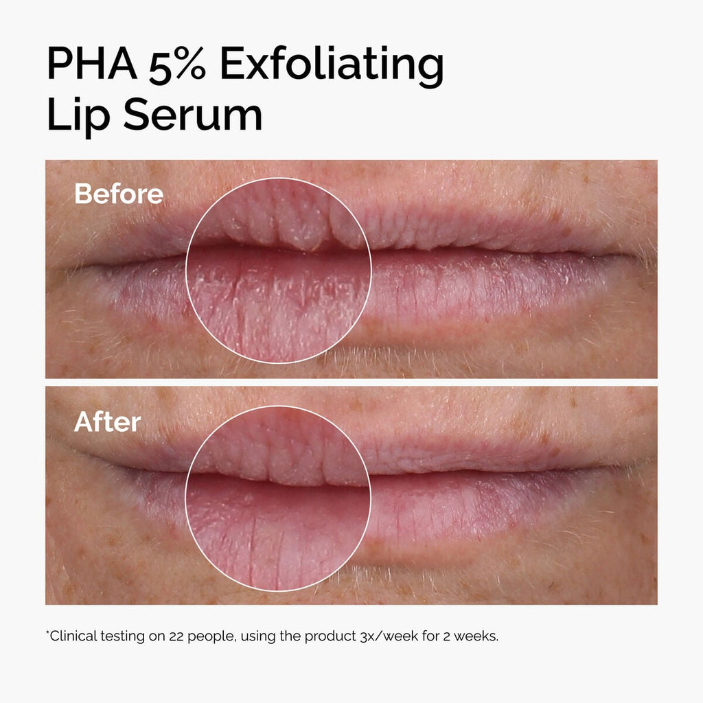 PHA Exfoliating Lip Serum Daily Treatment Ritual H0