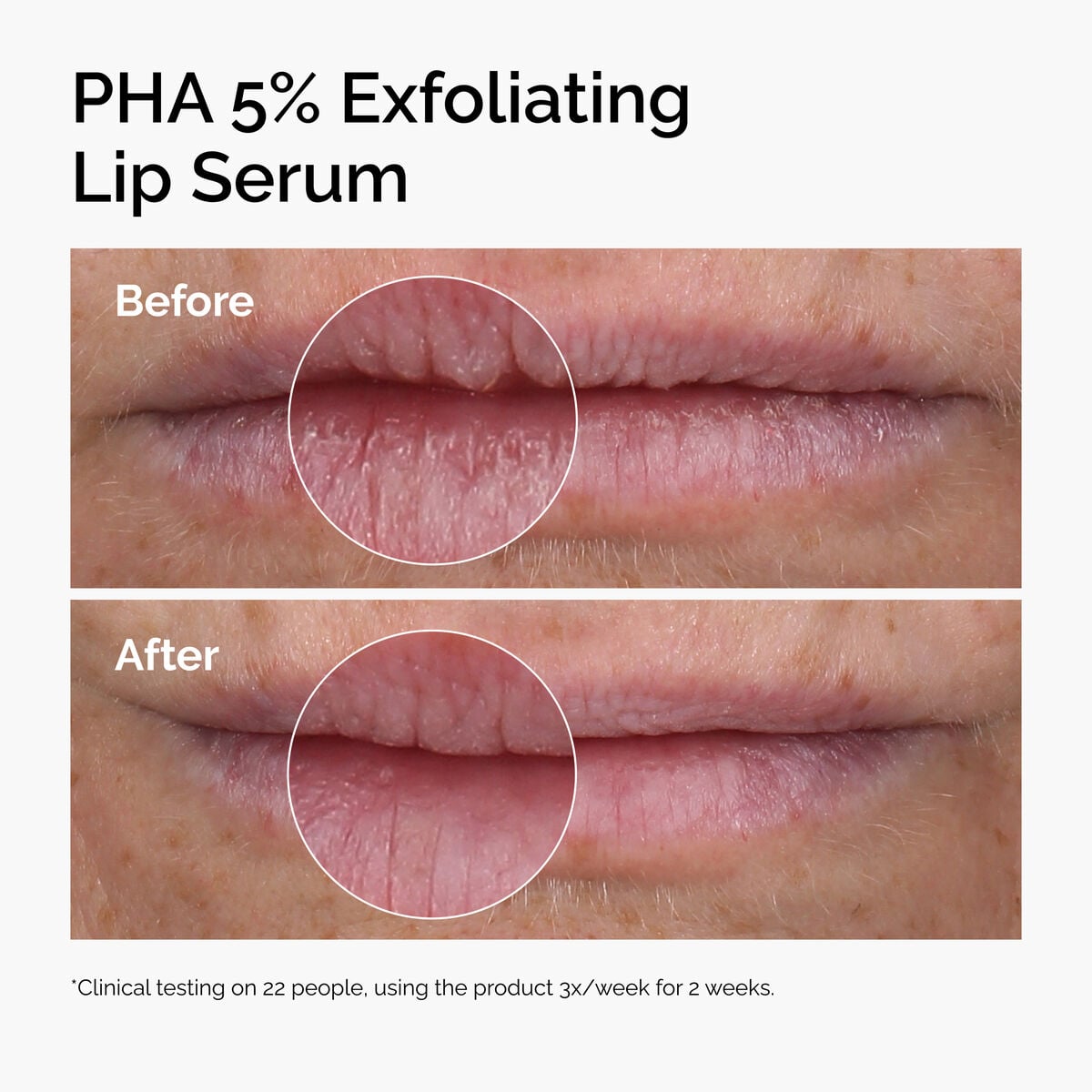 PHA Exfoliating Lip Serum Targeted Serum Care D6