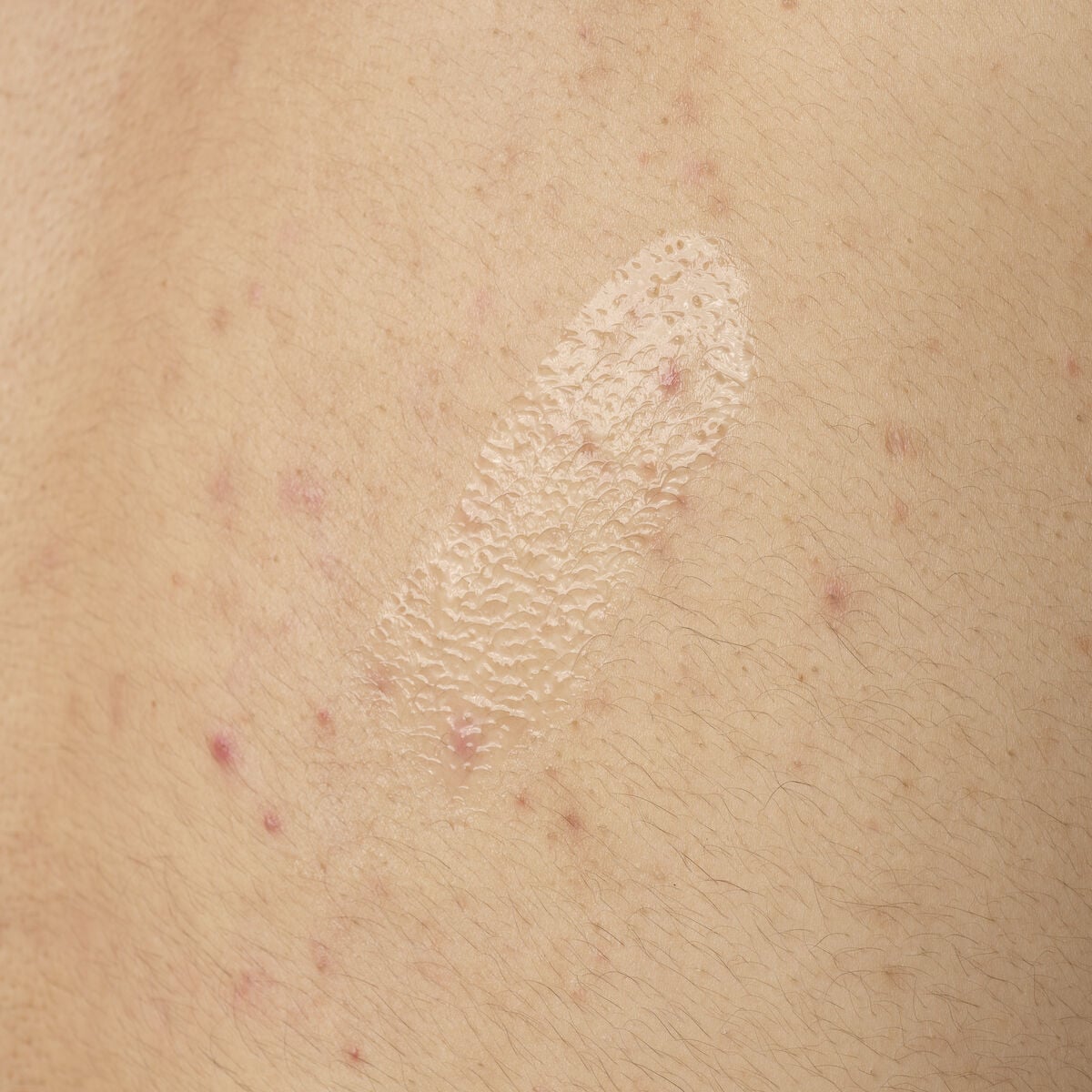 Salicylic Acid Body Serum Targeted Serum Care A6