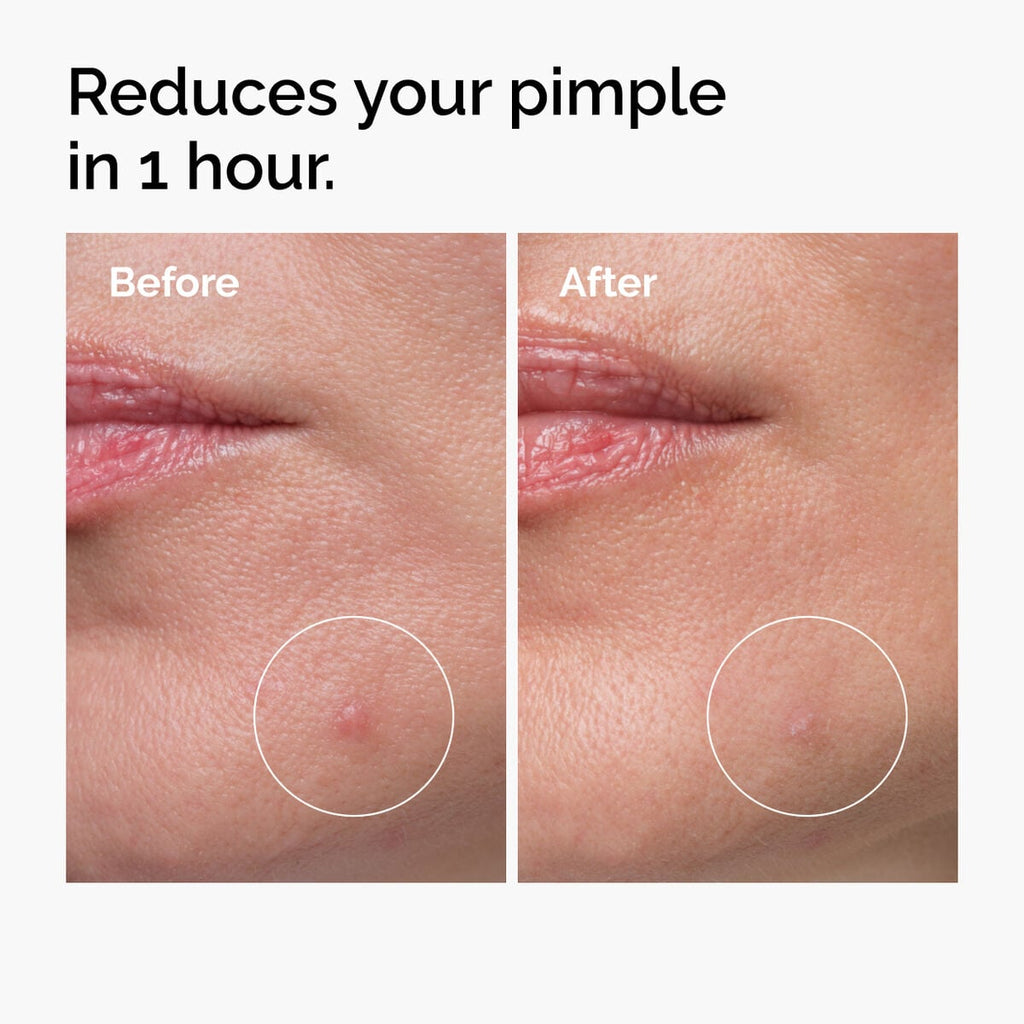 Sulfur Powder-to-Cream Concentrate Targeted Serum Care M7